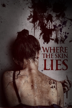 Watch Free Where the Skin Lies Full Movies MyFamilyTV