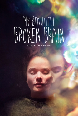 Watch Free My Beautiful Broken Brain Full Movies MyFamilyTV